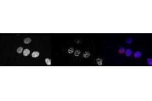 Image no. 1 for anti-RNA Polymerase II CTD (pSer5) antibody (ABIN1742594) (Rpb1 CTD antibody  (pSer5))