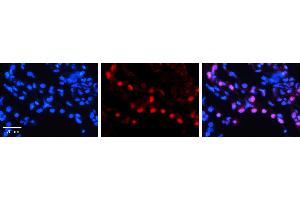 DNAJB1 antibody - N-terminal region (ARP54795_P050) Catalog Number: ARP54795_P050  Formalin Fixed Paraffin Embedded Tissue: Human Lung Tissue  Observed Staining: Nucleus of pneumocytes Primary Antibody Concentration: 1:100  Secondary Antibody: Donkey anti-Rabbit-Cy3  Secondary Antibody Concentration: 1:200  Magnification: 20X  Exposure Time: 0. (DNAJB1 antibody  (N-Term))
