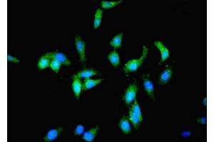 Immunofluorescent analysis of Hela cells using ABIN7163258 at dilution of 1:100 and Alexa Fluor 488-congugated AffiniPure Goat Anti-Rabbit IgG(H+L) (PCK1 antibody  (AA 1-622))