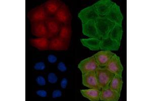 ABIN6264679 and ABIN6278276 staining Hela cells(30 min of UV treatment) by IF/ICC.