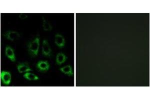 Immunofluorescence analysis of A549 cells, using MBTPS2 Antibody.