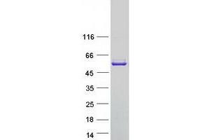 Validation with Western Blot (Glutathione Reductase Protein (GSR) (Myc-DYKDDDDK Tag))