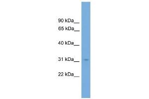 WB Suggested Anti-NRBF2 Antibody Titration:  0.