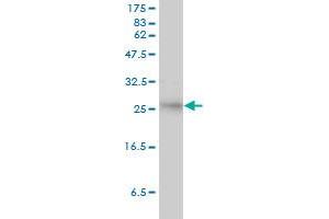 SMN2 antibody  (AA 1-282)