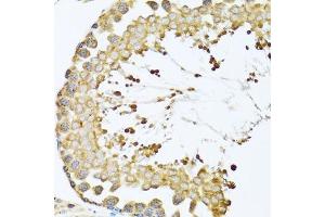 Immunohistochemistry of paraffin-embedded mouse testis using CCT4 antibody. (CCT4 antibody  (AA 130-390))