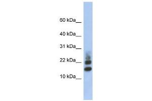 RPS15A antibody used at 1 ug/ml to detect target protein. (RPS15A antibody  (Middle Region))