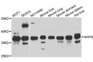 Western blot analysis of extracts of various cell lines, using rprd1b antibody (ABIN4905047) at 1:1000 dilution. (RPRD1B antibody)