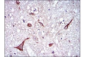 Immunohistochemical analysis of paraffin-embedded brain tissues using NEFL mouse mAb with DAB staining. (NEFL antibody)