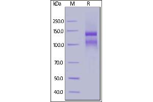 Human ITGAE&ITGB7 Heterodimer Protein, His Tag&Tag Free on  under reducing (R) condition.