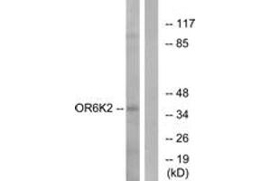 Western blot analysis of extracts from HeLa cells, using OR6K2 Antibody. (OR6K2 antibody  (AA 271-320))