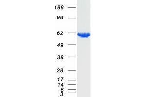 Validation with Western Blot (PKLR Protein (Transcript Variant 1) (Myc-DYKDDDDK Tag))