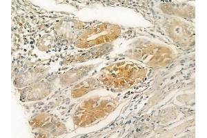ABIN6259493 and ABIN6274910 at 1/100 staining human normal gastric tissue by IHC-P.