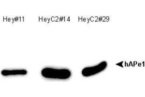 Image no. 1 for anti-DNA Repair Protein Apurinic Endonuclease antibody (ABIN5693483) (DNA Repair Protein Apurinic Endonuclease antibody)