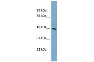 ST8SIA6 antibody used at 1 ug/ml to detect target protein. (ST8SIA6 antibody  (Middle Region))