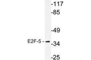 Western blot analysis of E2F-5 antibody in extracts from HeLa cells. (E2F5 antibody)