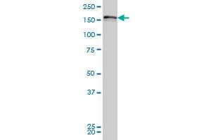 LRRFIP1 monoclonal antibody (M02), clone 2D3 Western Blot analysis of LRRFIP1 expression in Hela S3 NE .