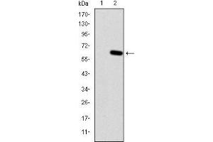 Western Blotting (WB) image for anti-Hemochromatosis (HFE) antibody (ABIN969192)