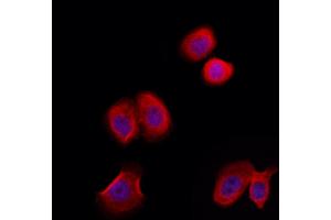 ABIN6258544 and ABIN6274949 staining Hela by IF/ICC.