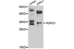 Western blot analysis of extract of various cells, using RSPO1 antibody.