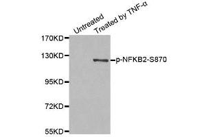 Western blot analysis of extract from MDA-MB-435 cells, using Phospho-NFKB2-S870 antibody (ABIN2988217). (NFKB2 antibody  (pSer870))