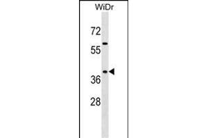 SY Antibody (C-term) 7291b western blot analysis in WiDr cell line lysates (35 μg/lane). (SYAP1 antibody  (C-Term))