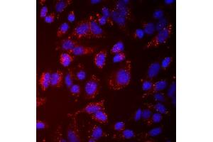 IF analysis of NDP52/CALCOCO2 using anti-NDP52/CALCOCO2 antibody (ABIN7599401). (CALCOCO2 antibody  (AA 1-446))