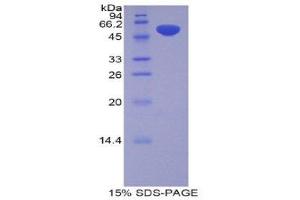 SDS-PAGE (SDS) image for Pregnancy Zone Protein (PZP) (AA 1251-1500) protein (His tag,GST tag) (ABIN2123498) (PZP Protein (AA 1251-1500) (His tag,GST tag))