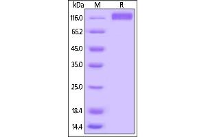 SDS-PAGE (SDS) image for Fms-Related Tyrosine Kinase 4 (FLT4) (AA 25-776) (Active) protein (His tag,AVI tag,Biotin) (ABIN5674609)