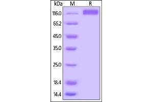 Biotinylated Human VEGF R3, His,Avitag on  under reducing (R) condition. (FLT4 Protein (AA 25-776) (His tag,AVI tag,Biotin))