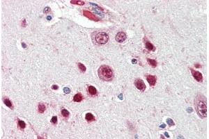 Human Brain, Cortex (formalin-fixed, paraffin-embedded) stained with NOVA1 antibody ABIN461953 at 2. (NOVA1 antibody  (AA 121-134))