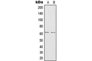 Western blot analysis of IL-20RA expression in A375 (A), MCF7 (B) whole cell lysates. (IL20RA antibody  (Center))