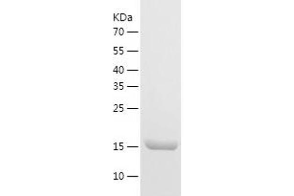 HMGB3 Protein (AA 1-180) (His tag)