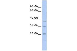 WB Suggested Anti-MCTS1 Antibody Titration:  0. (MCTS1 antibody  (N-Term))