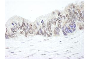 anti-Ribosomal Protein L26 (RPL26) (C-Term) antibody