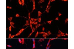 Immunofluorescence analysis of NIH/3T3 cells using GARS Polyclonal Antibody at dilution of 1:100. (GARS antibody)