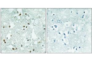 Immunohistochemistry analysis of paraffin-embedded human brain tissue, using ELAC2 antibody. (ELAC2 antibody  (Internal Region))