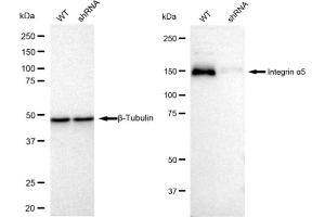 Western blotting analysis using Integrin alpha 5 antibody (ABIN7799077).