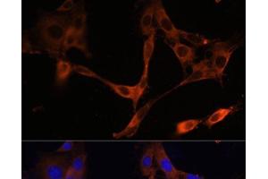 Immunofluorescence analysis of NIH/3T3 cells using HMGCR Polyclonal Antibody at dilution of 1:100. (HMGCR antibody)