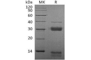 Western Blotting (WB) image for Cathepsin S (CTSS) protein (His tag) (ABIN7320704) (Cathepsin S Protein (CTSS) (His tag))