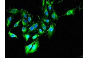 Immunofluorescent analysis of Hela cells using ABIN7171341 at dilution of 1:100 and Alexa Fluor 488-congugated AffiniPure Goat Anti-Rabbit IgG(H+L) (TIMD4 antibody  (AA 134-301))