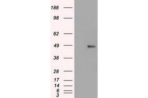 HEK293T cells were transfected with the pCMV6-ENTRY control (Left lane) or pCMV6-ENTRY FOXA1 (Right lane) cDNA for 48 hrs and lysed. (FOXA1 antibody  (AA 1-473))