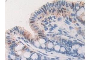 Immunohistochemistry (IHC) image for anti-Fibrinogen beta Chain (FGB) (AA 35-481) antibody (ABIN7433273)
