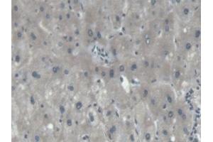 Detection of PIIINP in Human Liver Tissue using Polyclonal Antibody to Procollagen III N-Terminal Propeptide (PIIINP) (PIIINP antibody)