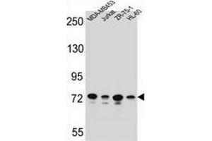 Western blot analysis in MDA-MB453,Jurkat,ZR-75-1,HL-60 cell line lysates (35ug/lane) using PCDHB15  Antibody (N-term). (PCDHB15 antibody  (N-Term))