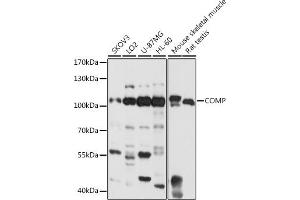 Western blot analysis of extracts of various cell lines, using COMP antibody (ABIN6127649, ABIN6138863, ABIN6138865 and ABIN6218152) at 1:1000 dilution. (COMP antibody  (AA 20-160))