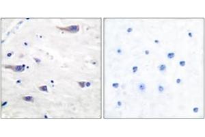 Immunohistochemistry analysis of paraffin-embedded human brain tissue, using PDGF Receptor beta (Ab-751) Antibody. (PDGFRB antibody  (AA 718-767))