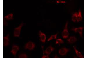 ABIN6274745 staining Hela by IF/ICC. (MRPL51 antibody  (C-Term))