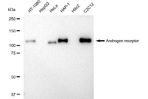 Western blotting analysis using Androgen receptor antibody (ABIN7797600).