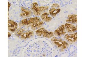 Immunohistochemistry of paraffin-embedded human kidney using LYZ antibody (ABIN5997039) at dilution of 1/100 (40x lens). (LYZ antibody)