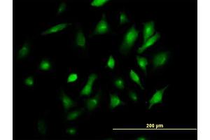 Immunofluorescence of purified MaxPab antibody to BST2 on HeLa cell. (BST2 antibody  (AA 1-180))